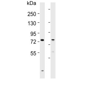 Western blot testing of human 1) liver and 2) ovary lysate with SLCO1B3 antibody. Expected molecular weight: 77-120 kDa depending on glycosylation level.
