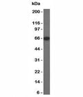 Western blot of Estrogen Receptor in MCF-7 lysate using Estrogen Receptor antibody (SPM567).