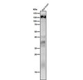 Western blot analysis of Delta 2 Catenin expression in rat brain cell lysate using CTNND2 antibody. Predicted molecular weight ~133 kDa.