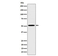 Western blot testing of human HepG2 cell lysate with HNF4A antibody. Predicted molecular weight ~50 kDa.