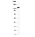 Western blot testing of TIE2 antibody and MCF-7 lysate; Predicted molecular weight: ~126 kDa but may be observable at 130-165 kDa.