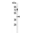 Western blot testing of human NCI-H460 cell lysate with Growth arrest-specific protein 1 antibody. Predicted molecular weight ~36 kDa but may be observed at higher molecular weights due to glycosylation.