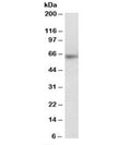 Western blot testing of MOLT4 lysate with SOCS5 antibody at 0.3ug/ml. Predicted molecular weight: ~61kDa.