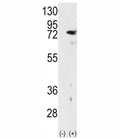 Western blot analysis of PKC delta antibody and 293 cell lysate either nontransfected (Lane 1) or transiently transfected with the PRKCD gene (2).