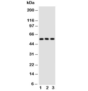 Western blot testing of GLUT5 antibody and Lane 1: rat kidney; 2: rat liver; 3: mouse kidney tissue lysate. Expected/observed molecular weight ~55 kDa.