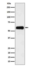 Western blot analysis of CD116 in human 293 cell lysate using CD116 antibody. A predominant band is detected at an approximately 55-60 kDa, running above the predicted ~46-47 kDa size but consistent with the higher apparent molecular weight reported for the heavily N glycosylated receptor.