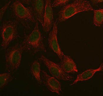 Immunofluorescent staining of MAN2C1 using anti-MAN2C1 antibody (green) and anti-Beta Tubulin antibody (red). MAN2C1 was detected in immunocytochemical section of U2OS cell. Enzyme antigen retrieval was performed using IHC enzyme antigen retrieval reagent for 15 mins. The cells were blocked with 10% goat serum. And then incubated with 5 ug/ml rabbit anti-MAN2C1 antibody and mouse anti-Beta Tubulin antibody overnight at 4oC.