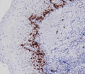 IHC testing of FFPE human tonsil tissue with Ki67 antibody. HIER: steam section in pH9 EDTA for 20 min and allow to cool prior to staining.