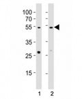 Western blot testing of EED antibody at 1:1000 dilution. Lane 1: A431 lysate; 2: NIH3T3 lysate; Predicted molecular weight: 50 kDa (isoform 1), 53 kDa (isoform 2), 46 kDa (isoform 3).