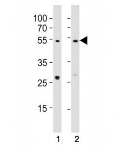 Western blot testing of EED antibody at 1:1000 dilution. Lane 1: A431 lysate; 2: NIH3T3 lysate; Predicted molecular weight: 50 kDa (isoform 1), 53 kDa (isoform 2), 46 kDa (isoform 3).