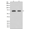 Western blot testing of human 1) HeLa and 2) 239T cell lysate with CHEK2 antibody. Predicted molecular weight ~61 kDa.