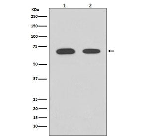 Western blot testing of human 1) HeLa and 2) 239T cell lysate with CHEK2 antibody. Predicted molecular weight ~61 kDa.