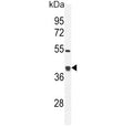 Western blot testing of mouse bladder tissue lysate with Glutaredoxin 3 antibody. Predicted molecular weight ~37 kDa.