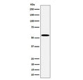 Western blot testing of human Jurkat cell lysate with PNKP antibody. Predicted molecular weight ~57 kDa.