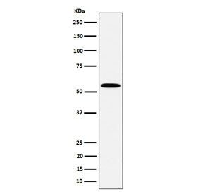 Western blot testing of human Jurkat cell lysate with PNKP antibody. Predicted molecular weight ~57 kDa.