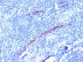 IHC testing of FFPE human tonsil with recombinant CD34 antibody (clone HPCA1/1806R). Required HIER: boil tissue sections in 10mM Tris with 1mM EDTA, pH 9, for 10-20 min followed by cooling at RT for 20 min.