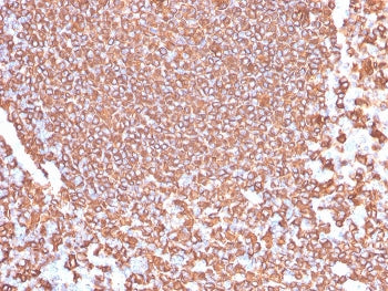 IHC testing of FFPE human tonsil tissue with recombinant CD20 antibody (clone IGEL/4524R). HIER: boil tissue sections in pH6, 10mM citrate buffer, for 20 min and allow to cool before testing.