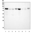 Western blot testing of PAK1 antibody and Lane 1: rat testis; 2: rat spleen; 3: SW620; 4: MCF-7; 5: CEM; 6: HT1080; Expected molecular weight 60~70kDa.