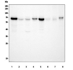 Western blot testing of PAK1 antibody and Lane 1: rat testis; 2: rat spleen; 3: SW620; 4: MCF-7; 5: CEM; 6: HT1080; Expected molecular weight 60~70kDa.