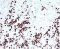 IHC staining of FFPE human spleen tissue with Lysozyme C antibody (clone LYZ/3943). HIER: boil tissue sections in pH 9 10mM Tris with 1mM EDTA for 20 min and allow to cool before testing.