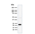 Western blot testing of human Jurkat cell lysate with CD3e antibody (clone C3e/1308). Predicted molecular weight ~23 kDa.
