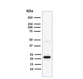 Western blot testing of human Jurkat cell lysate with CD3e antibody (clone C3e/1308). Predicted molecular weight ~23 kDa.
