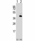 Western blot analysis of PITX1 antibody and 293 cell lysate either nontransfected (Lane 1) or transiently transfected (2) with the PITX1 gene. Predicted molecular weight ~34 kDa.