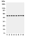 Western blot testing of P2X2 antibody and Lane 1: rat brain; 2: mouse brain; 3: human placenta; 4: (h) HeLa; 5: (h) SHG-44; 6: (m) Neuro-2a; 7: (h) 22RV1; 8: (h) U87 lysate. Expected size 41~55KD