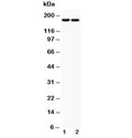 Western blot testing of Laminin antibody and Lane 1: HeLa; 2: HEPG2 lysate. Expected molecular weight: 172-200 kDa (G1 & G3), 130-140 kDa (G2).
