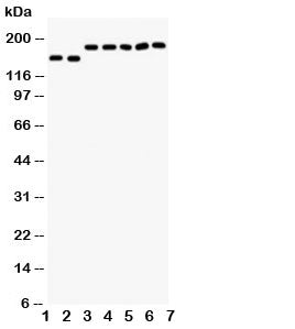 Western blot testing of DCC antibody and Lane 1: rat brain; 2: mouse brain; and human samples 3: U87; 4: SW620; 5: COLO320; 6: 293T; 7: HeLa cell lysate. Expected molecular weight: 155~190 kDa depending on glycosylation level.