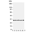 Western blot testing of Kallikrein-11 antibody and Lane 1: U87; 2: A549; 3: HeLa; 4: MM231; 5: MM453; 6: COLO320; 7: Jurkat cell lysate. Predicted size: ~27KD