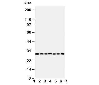 Western blot testing of Kallikrein-11 antibody and Lane 1: U87; 2: A549; 3: HeLa; 4: MM231; 5: MM453; 6: COLO320; 7: Jurkat cell lysate. Predicted size: ~27KD