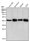 All lanes use the CABP1 antibody at 1:3K dilution for 1 hour at room temperature. Predicted molecular weight ~40 kDa.