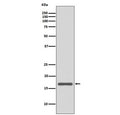 Western blot testing of human MCF7 cell lysate with AGR2 antibody. Expected molecular weight: 17-20 kDa.