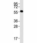 Western blot testing of PRMT3 antibody at 1:2000 dilution + mouse brain lysate; Predicted molecular weight: 55-60 kDa.