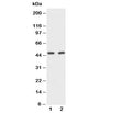 Western blot testing of CD2 antibody and Lane 1: rat spleen; 2: mouse NIH3T3 cell lysate