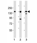 AXL antibody at 1:2000 dilution. Lane 1: NCI-H1299 lysate; 2: HeLa lysate; 3: L6 lysate; Predicted molecular weight is 104 kDa unglycosylated, 120-140 kDa with glycosylation