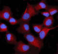Immunofluorescent staining of STIM2 using anti-STIM2 antibody (red). STIM2 was detected in an immunocytochemical section of human HeLa cells. Enzyme antigen retrieval was performed using IHC enzyme antigen retrieval reagent for 15 mins. The cells were blocked with 10% goat serum. And then incubated with 5 ug/ml rabbit anti-STIM2 antibody overnight at 4oC. Cy3 Conjugated Goat Anti-Rabbit IgG was used as secondary antibody at 1:500 dilution and incubated for 30 min at 37oC.
