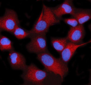Immunofluorescent staining of STIM2 using anti-STIM2 antibody (red). STIM2 was detected in an immunocytochemical section of human HeLa cells. Enzyme antigen retrieval was performed using IHC enzyme antigen retrieval reagent for 15 mins. The cells were blocked with 10% goat serum. And then incubated with 5 ug/ml rabbit anti-STIM2 antibody overnight at 4oC. Cy3 Conjugated Goat Anti-Rabbit IgG was used as secondary antibody at 1:500 dilution and incubated for 30 min at 37oC.