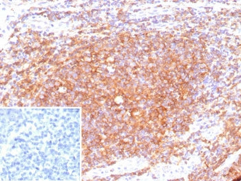 IHC staining of FFPE human tonsil tissue with recombinant CD40 antibody (clone C40/9225R). Inset: PBS used in place of primary Ab (secondary Ab negative control). HIER: boil tissue sections in pH 9 10mM Tris with 1mM EDTA for 20 min and allow to cool before testing.