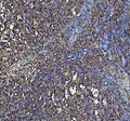 IHC staining of FFPE human tonsil tissue with IFNG antibody. HIER: boil tissue sections in pH8 EDTA for 20 min and allow to cool before testing.