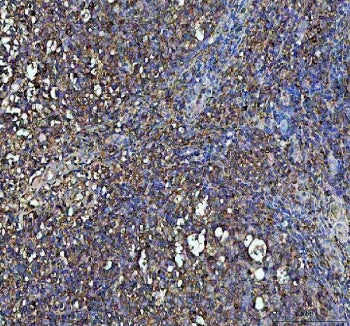 IHC staining of FFPE human tonsil tissue with IFNG antibody. HIER: boil tissue sections in pH8 EDTA for 20 min and allow to cool before testing.