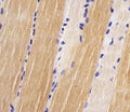 IHC testing of FFPE human skeletal muscle with Titin antibody at 1:25. HIER: steamed in pH6 citrate buffer.