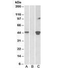 Western blot of HEK293 lysate overexpressing human SLAMF8-MYC probed with SLAMF8 antibody [1ug/ml] in (A) and anti-MYC [1/1000] in (C). Mock-transfected HEK293 probed with SLAMF8 antibody [1ug/ml] in (B). Predicted molecular weight: ~32/45kDa (unmodified/glycosylated).