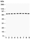 Western blot testing of GHR antibody and Lane 1: rat liver; 2: (r) kidney; 3: (r) spleen; 4: (r) intestine; 5: mouse spleen; 6: (m) testis; 7: (m) liver; 8: (m) kidney; 9: (m) intestine. Predicted molecular weight ~72 kDa but GHR can be glycosylated, ubiquitinated and complex with GH causing a larger than predicted size to be observed.