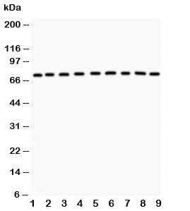 Western blot testing of GHR antibody and Lane 1: rat liver; 2: (r) kidney; 3: (r) spleen; 4: (r) intestine; 5: mouse spleen; 6: (m) testis; 7: (m) liver; 8: (m) kidney; 9: (m) intestine. Predicted molecular weight ~72 kDa but GHR can be glycosylated, ubiquitinated and complex with GH causing a larger than predicted size to be observed.