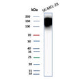 Western blot testing of human SK-MEL-28 cell lysate with CEACAM1 antibody (clone CEACAM1/12659). Predicted molecular weight ~58 kDa but may be observed at higher molecular weights due to heavy glycosylation.
