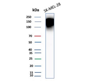 Western blot testing of human SK-MEL-28 cell lysate with CEACAM1 antibody (clone CEACAM1/12659). Predicted molecular weight ~58 kDa but may be observed at higher molecular weights due to heavy glycosylation.