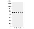 Western blot testing of AKT2 antibody and Lane 1: HeLa; 2: PANC; 3: A549; 4: COLO320; 5: HT1080; 6: MCF-7 lysate. Predicted molecular weight: ~56kDa.