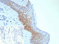 IHC staining of FFPE human skin tissue with Desmoglein-3 antibody (clone DSG3/8252R). Inset: PBS used in place of primary Ab (secondary Ab negative control). HIER: boil tissue sections in pH 9 10mM Tris with 1mM EDTA for 20 min and allow to cool before testing.